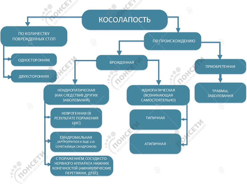 Классификация косолапости