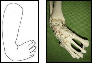 Компоненты косолапости